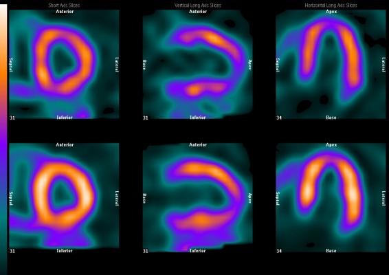 Societies Call for Focus on Radiation Dose Optimization in Nuclear